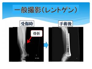 一般撮影（レントゲン）画像