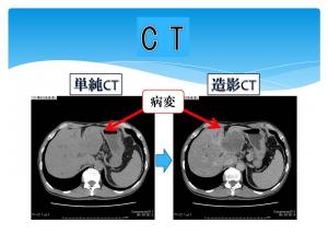 CT撮影画像