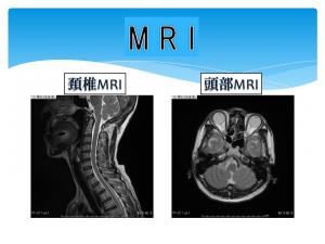 ＭＲＩ撮影画像